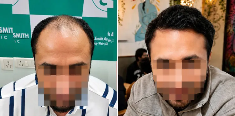 Modern hair transplant operating theatre, wide view